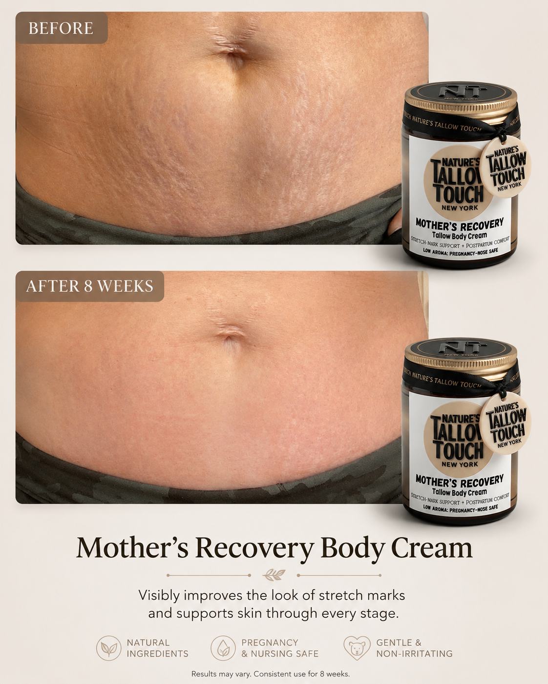 Mother’s Recovery Tallow Body Cream — Made for Stretching, Dry, Changing Skin.