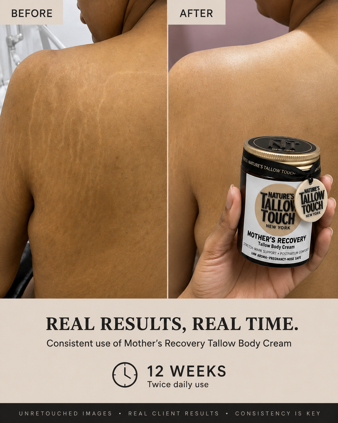 Mother’s Recovery Tallow Body Cream — Made for Stretching, Dry, Changing Skin.
