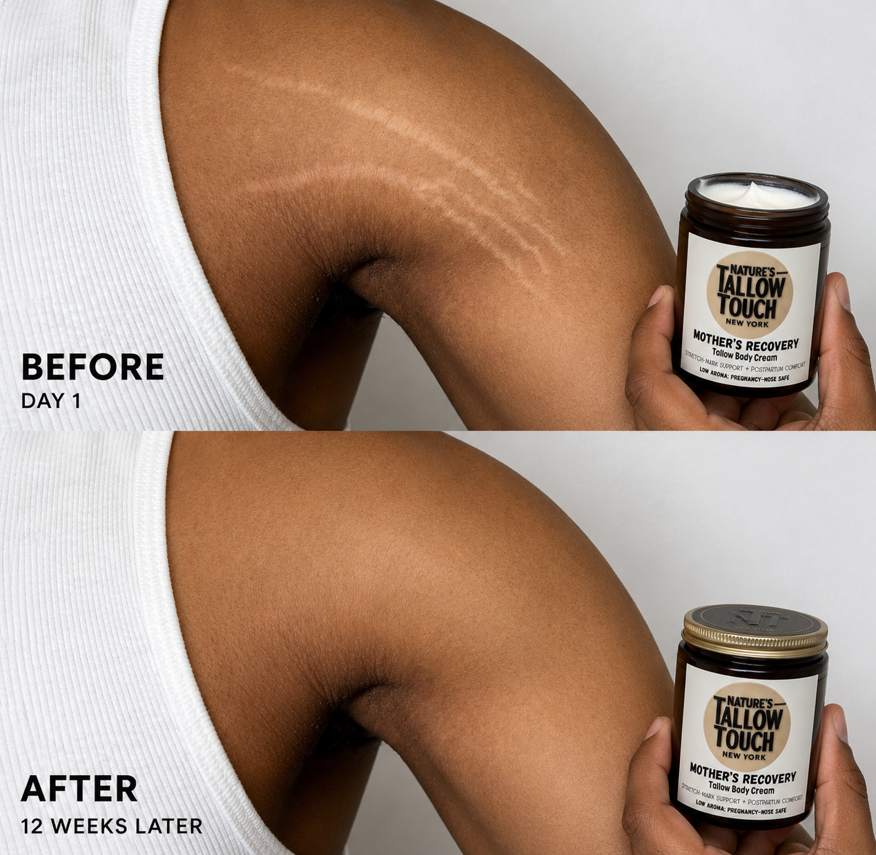 Mother’s Recovery Tallow Body Cream — Made for Stretching, Dry, Changing Skin.