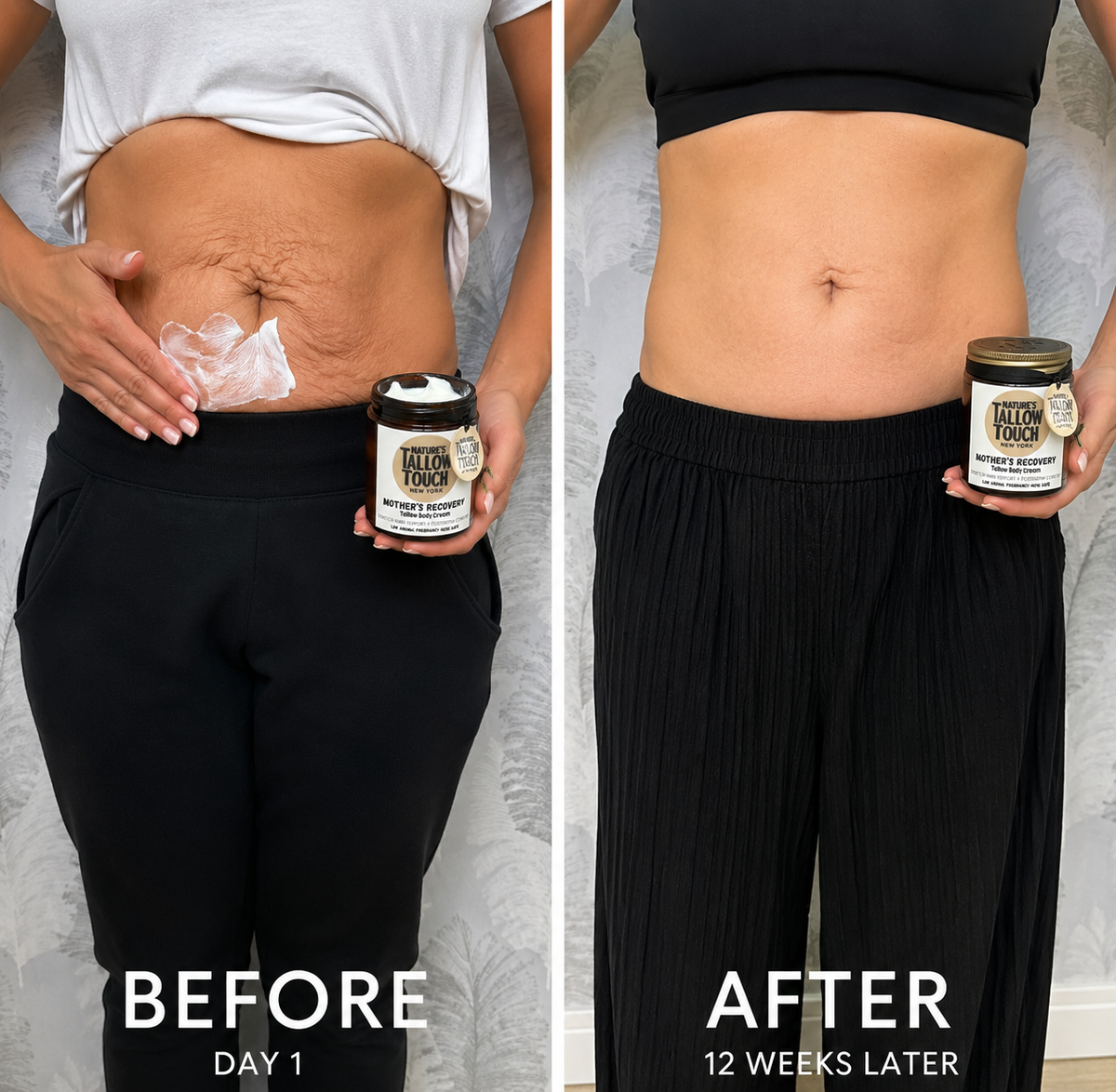 Mother’s Recovery Tallow Body Cream — Made for Stretching, Dry, Changing Skin.