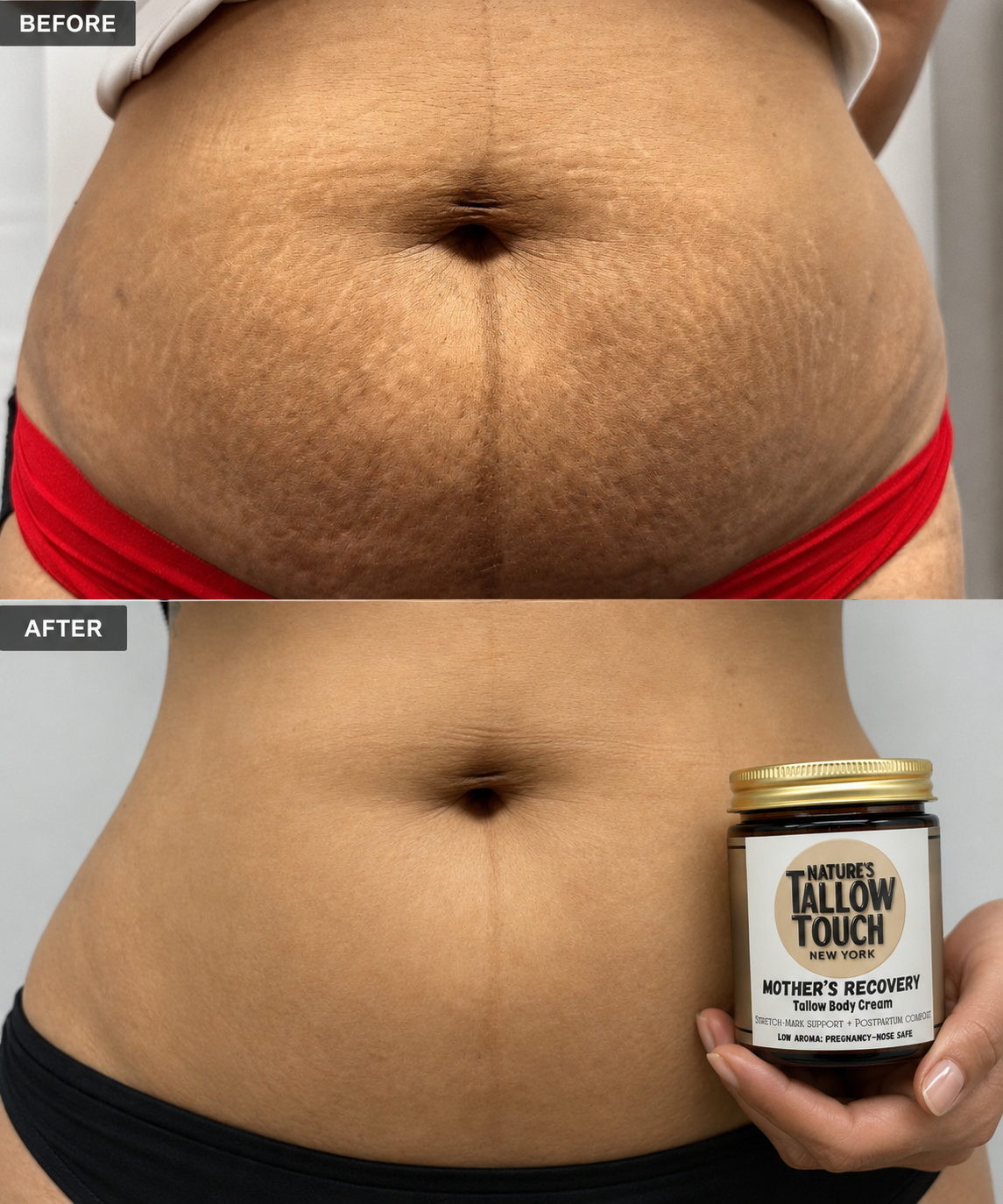 Mother’s Recovery Tallow Body Cream — Made for Stretching, Dry, Changing Skin. - Nature’s Tallow Touch LLC